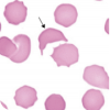 Hematology quiz App