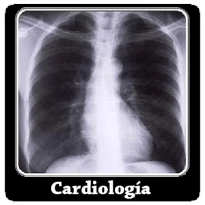 Cardiología preguntas de exam