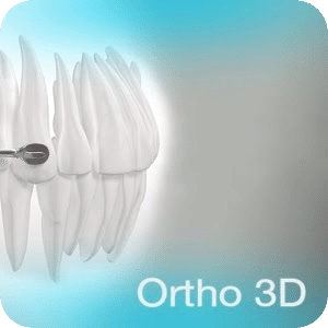 Carriere Ortho 3D