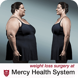 Mercy Bariatrics