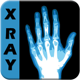 X Ray Scanner