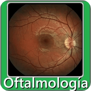Oftalmología preguntas de exam