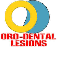 Oro Dental Lesions