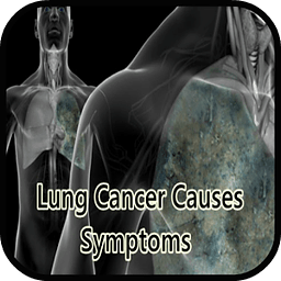 Lung Cancer Causes Sympt...