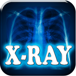 x射线扫描仪 X-Ray Scanne...