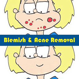 Blemish and Acne Removal