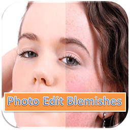 Photo Edit Blemishes Wik...