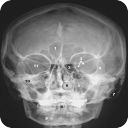Human X-ray Anatomy Lite
