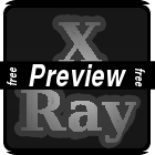 Free X-ray Film preview