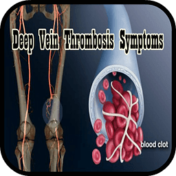 Deep Vein Thrombosis Sym...