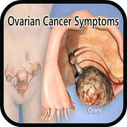 Ovarian Cancer Symptoms