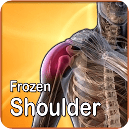 Frozen Shoulder