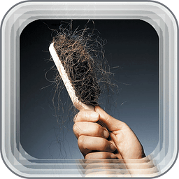 Hair Loss Disease &amp; Symp...