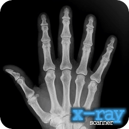 X-射线扫描仪 X-Ray Scanner