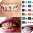 How to Make Fake Braces