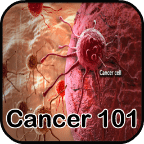 Cancer 101 Treatment