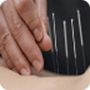 Acupuncture Tips