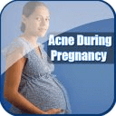 FREE Acne In Pregnancy Guide