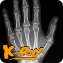X-Ray Droid Prank