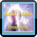 Laser Treatment Acne - Guide