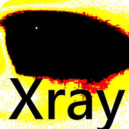 Xray透视镜头