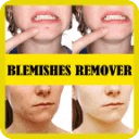 Blemishes Remover