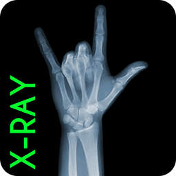 X-RAY BONES SCANNER