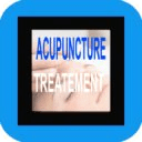 Acupuncture Treatment Tips