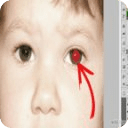 Edit Photo Red Eye Android