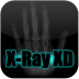X-Ray Scanner XD