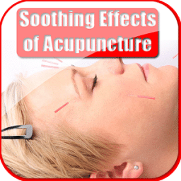 Soothing Effects of Acupuncture