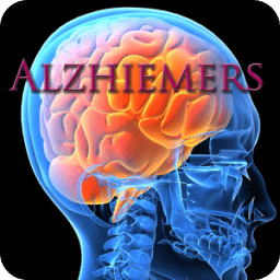 Alzheimers