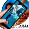 Camera X-Ray vision effect (SIMULATED)