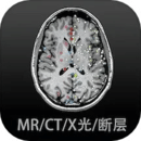 影像解剖圖譜